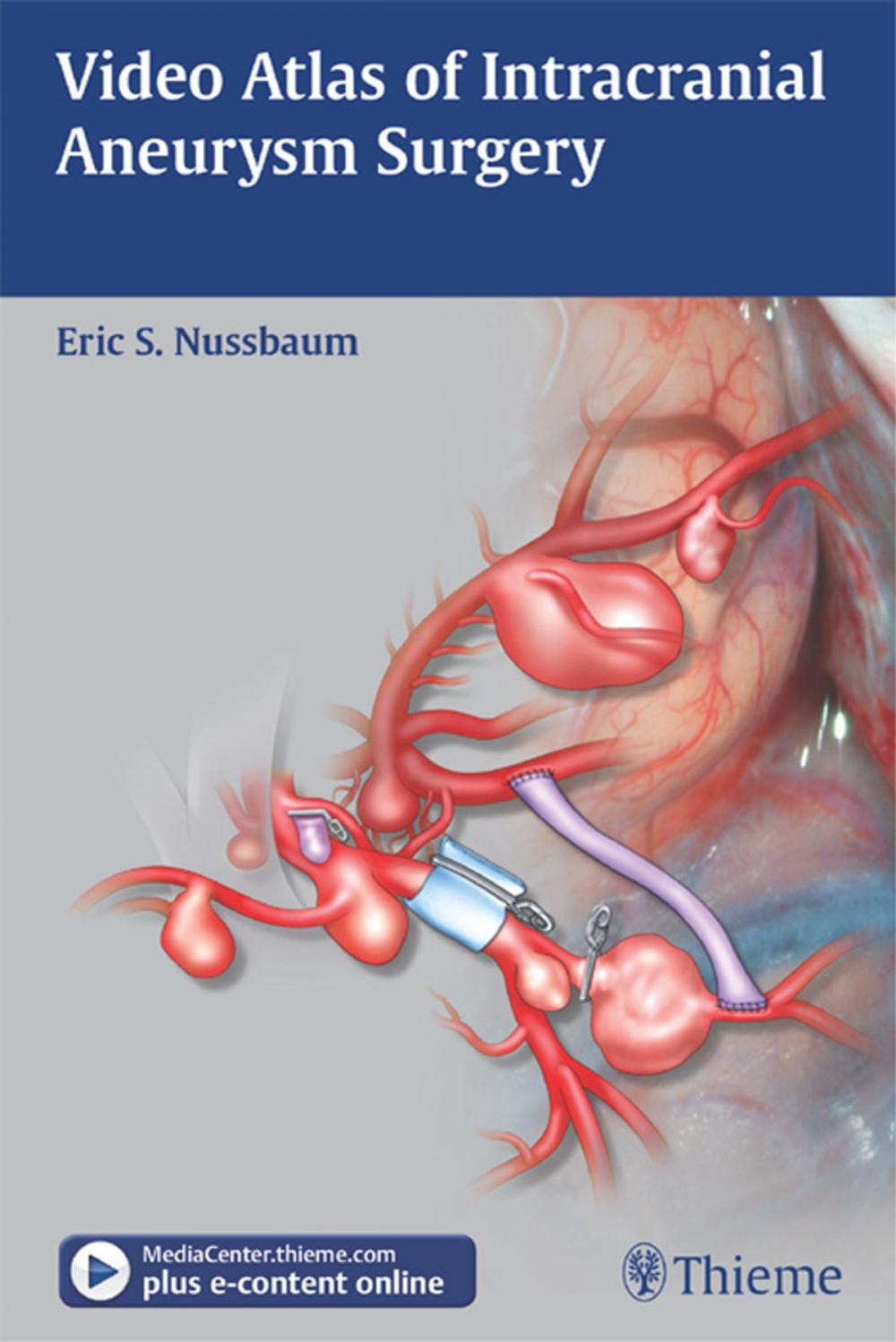 Big bigCover of Video Atlas of Intracranial Aneurysm Surgery