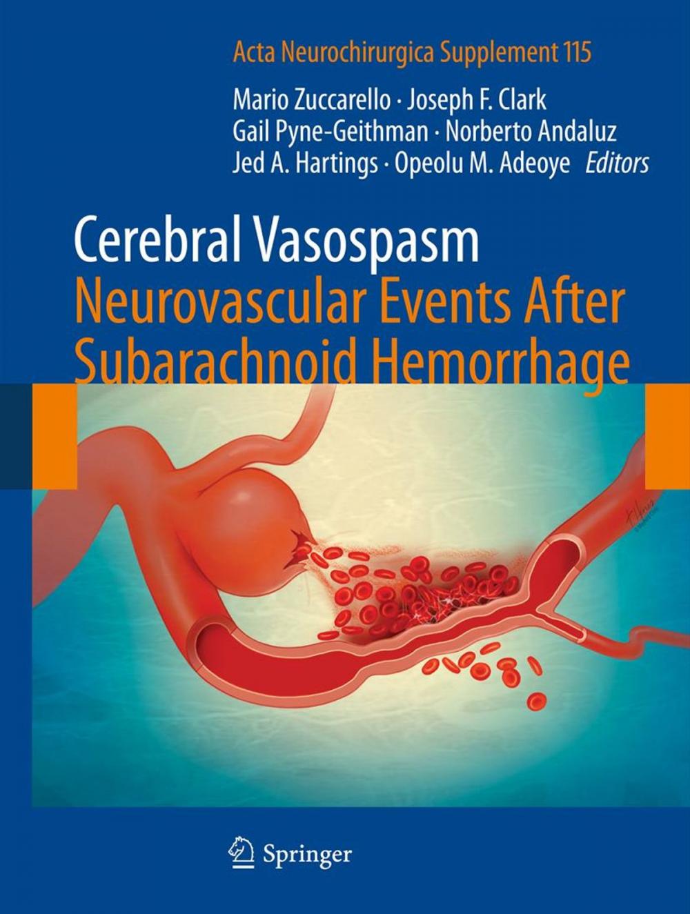 Big bigCover of Cerebral Vasospasm: Neurovascular Events After Subarachnoid Hemorrhage