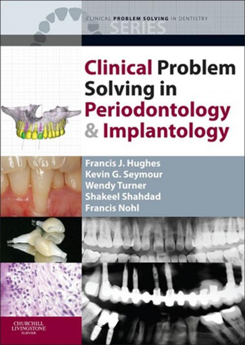 Cover of the book Clinical Problem Solving in Periodontology and Implantology - E-Book by Francis J. Hughes, BDS, PhD, FDS RCS, Professor Kevin G. Seymour, BDS MSc PhD DRD MRD MFGDP FHEA, Wendy Turner, BDS, FDS RCS(Eng), FDS (Rest Dent) RCS (Eng), Shakeel Shahdad, BDS, MMedSc, FDS RCS(Ed), FDS(RestDent) RCS(Ed), Francis Nohl, MBBS, BDS, FDSRCS, MRD, MSc, DDS, Elsevier Health Sciences