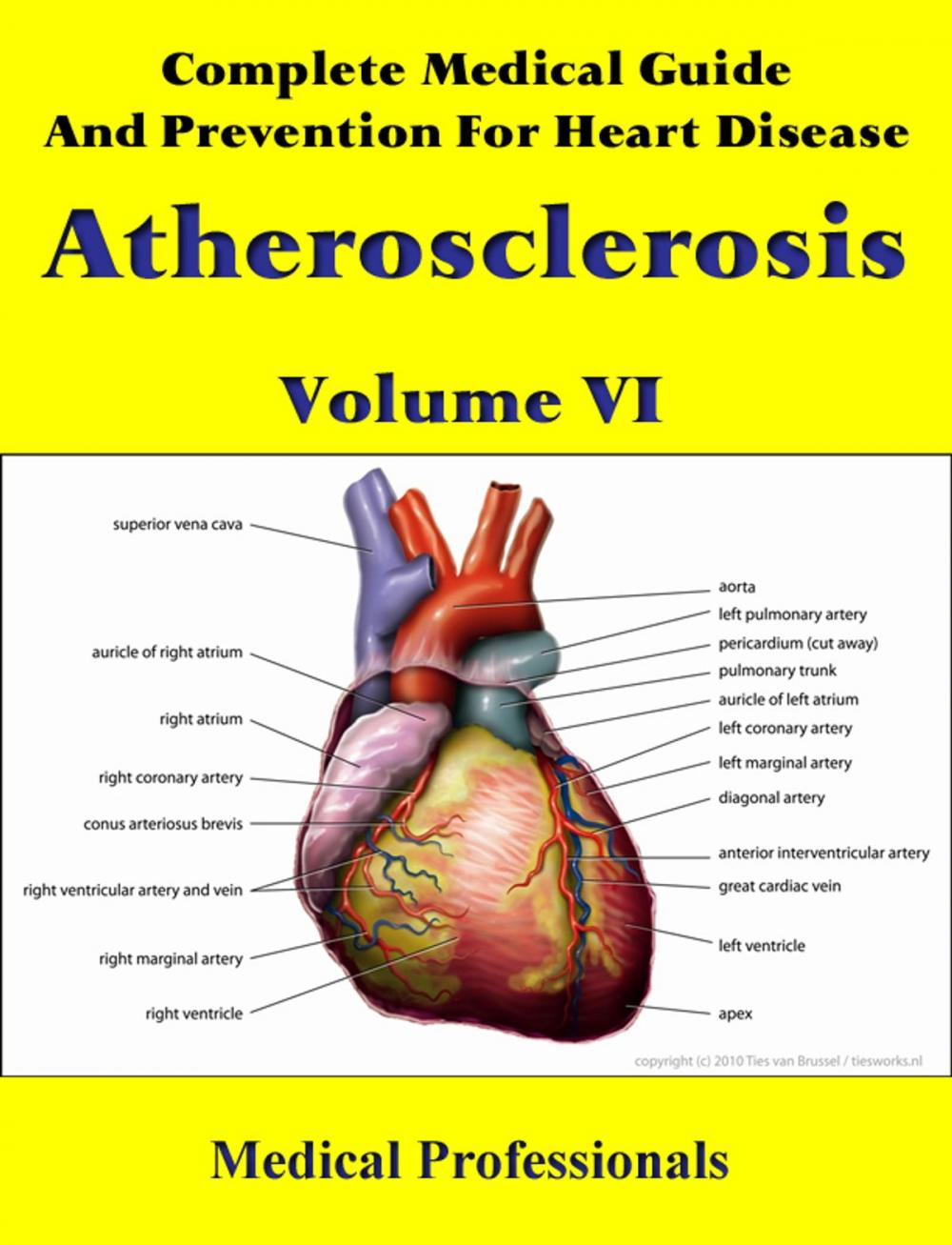 Big bigCover of Complete Medical Guide and Prevention for Heart Diseases Volume VI; Atherosclerosis