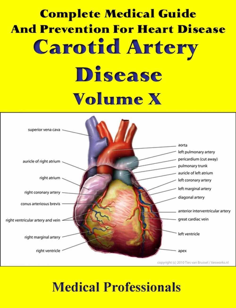 Big bigCover of Complete Medical Guide and Prevention for Heart Diseases Volume X; Carotid Artery Disease