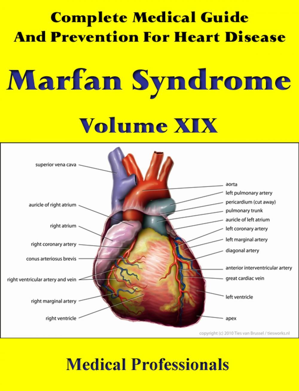 Big bigCover of A Complete Medical Guide and Prevention For Heart Diseases Volume XIX; Marfan Syndrome