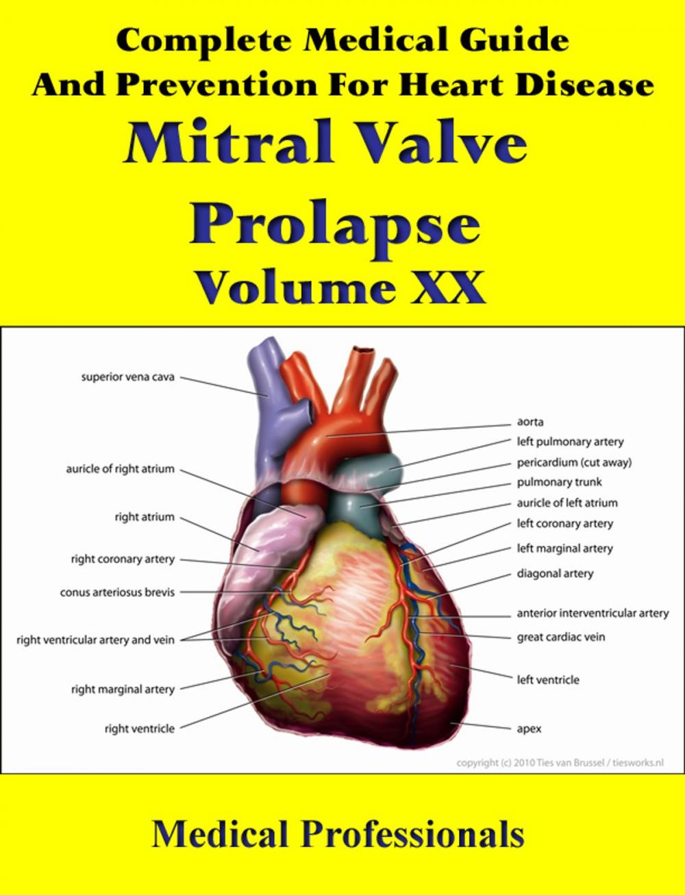 Big bigCover of A Complete Medical Guide and Prevention For Heart Diseases Volume XX; Mitral Valve Prolapse