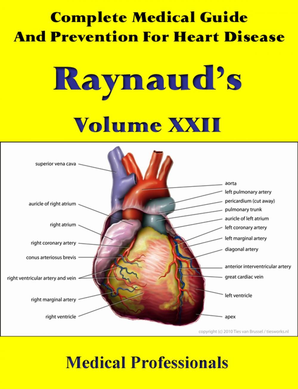 Big bigCover of A Complete Medical Guide and Prevention For Heart Diseases Volume XXII; Raynaud’s