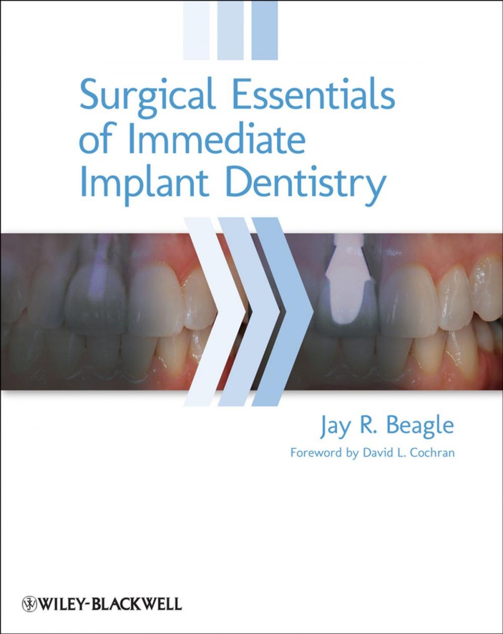 Big bigCover of Surgical Essentials of Immediate Implant Dentistry