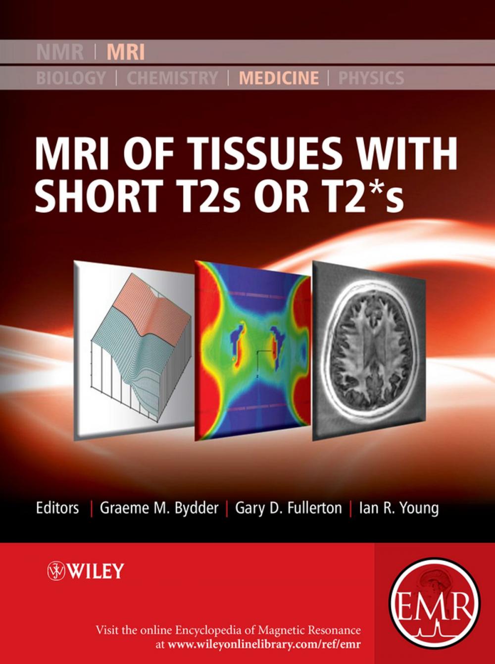 Big bigCover of MRI of Tissues with Short T2s or T2*s