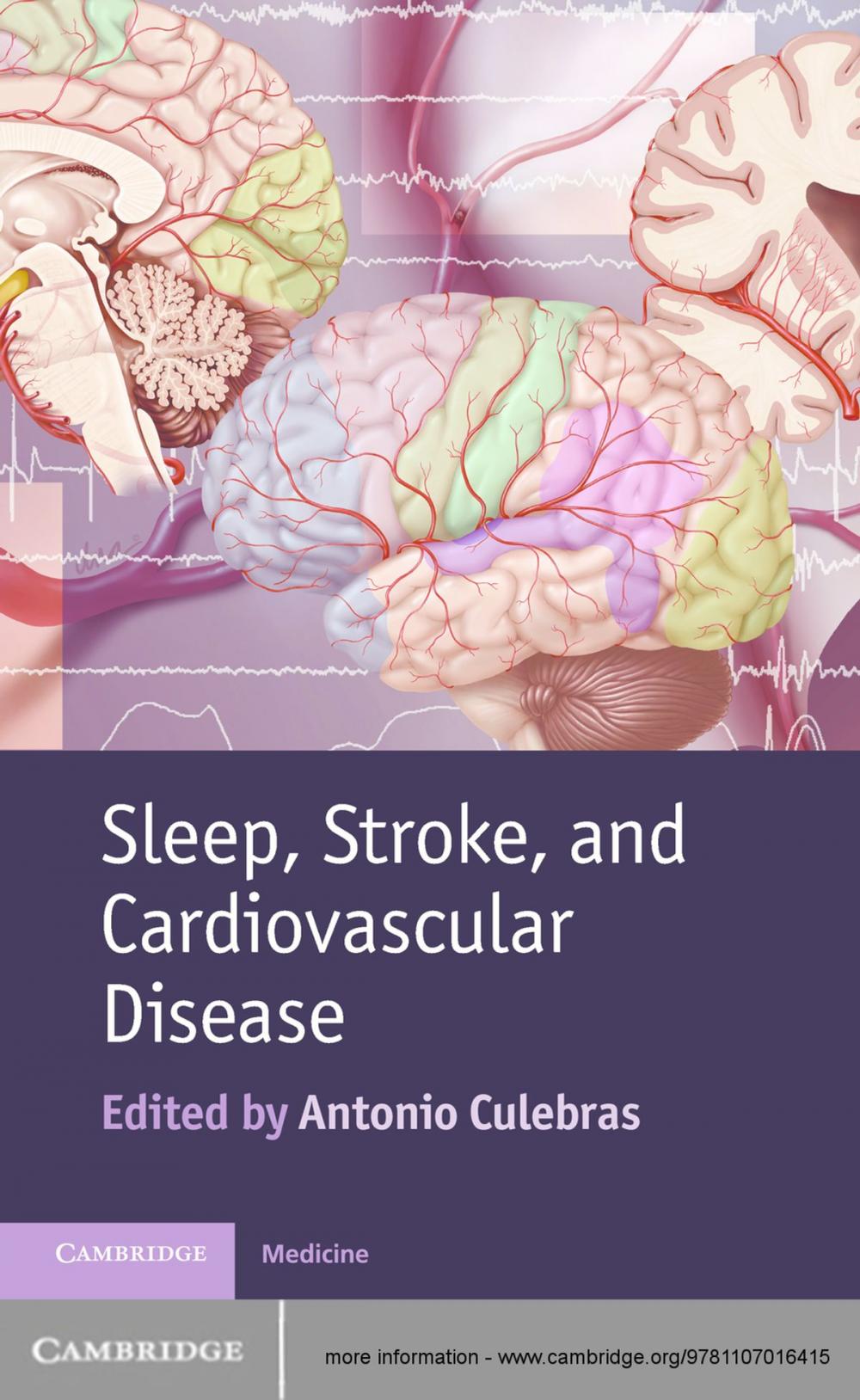 Big bigCover of Sleep, Stroke and Cardiovascular Disease