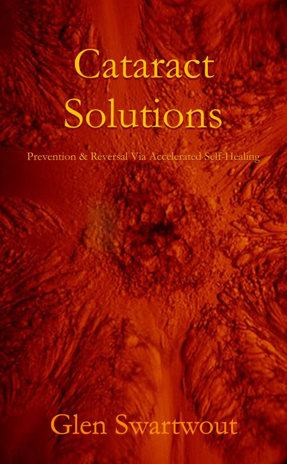 Big bigCover of Cataract Solutions: Prevention & Reversal Via Accelerated Self-Healing