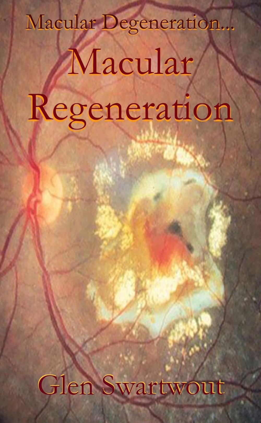 Big bigCover of Macular Degeneration... ...Macular Regeneration