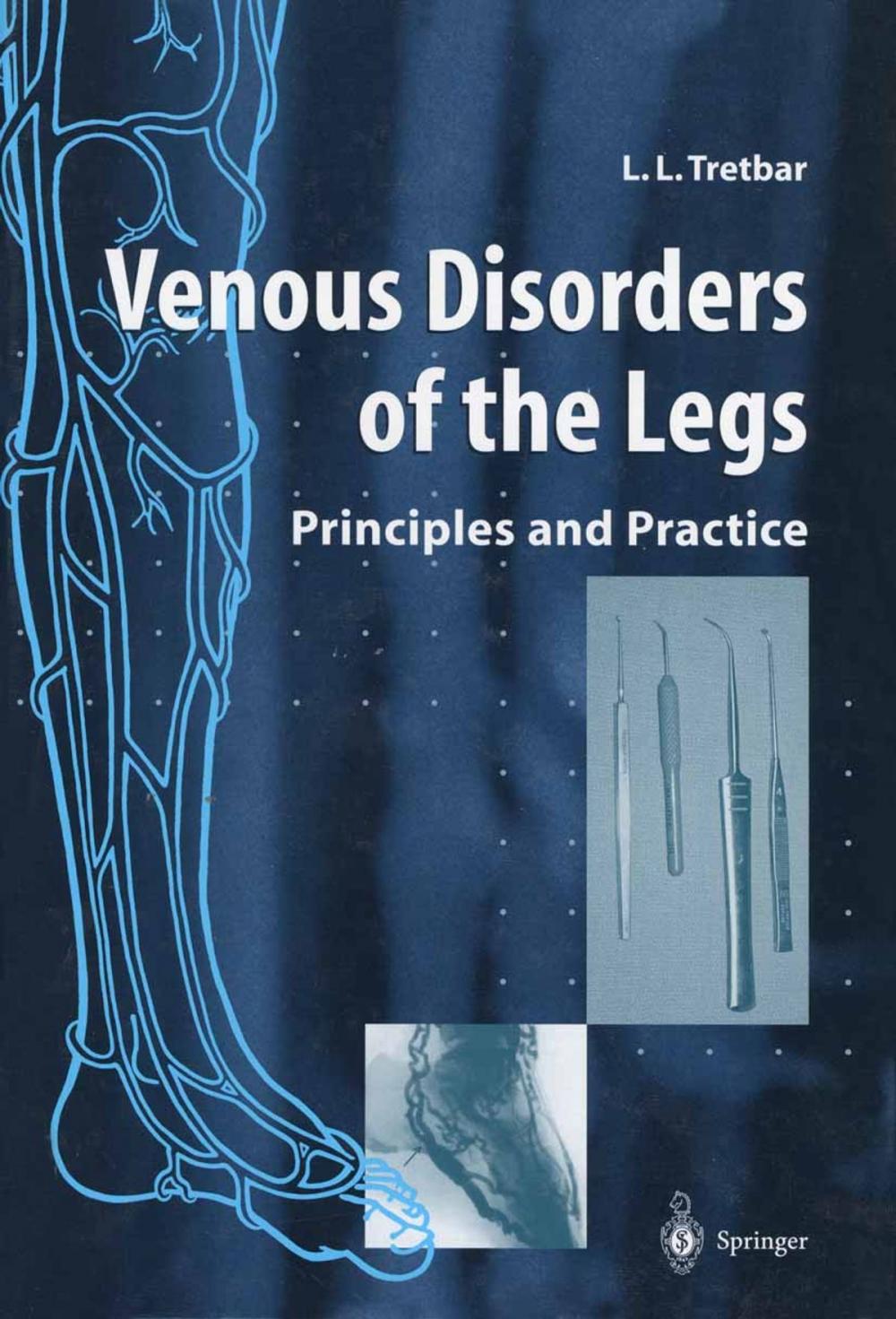 Big bigCover of Venous Disorders of the Legs