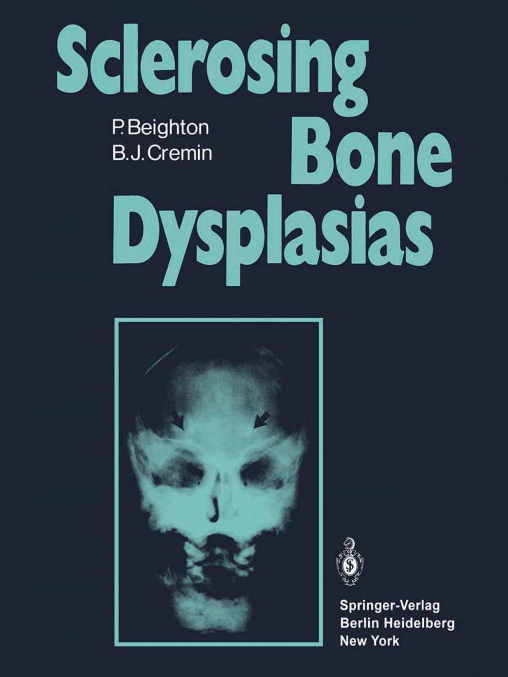 Big bigCover of Sclerosing Bone Dysplasias