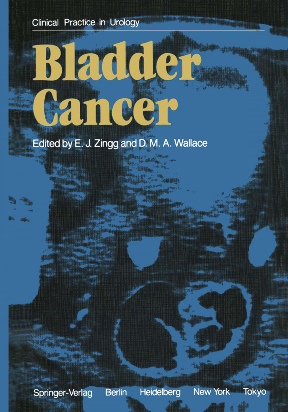 Big bigCover of Bladder Cancer