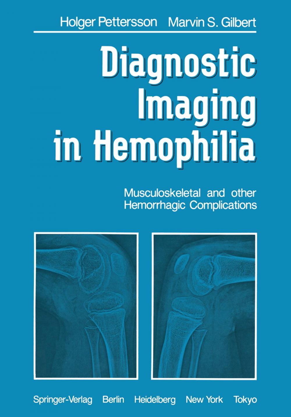 Big bigCover of Diagnostic Imaging in Hemophilia