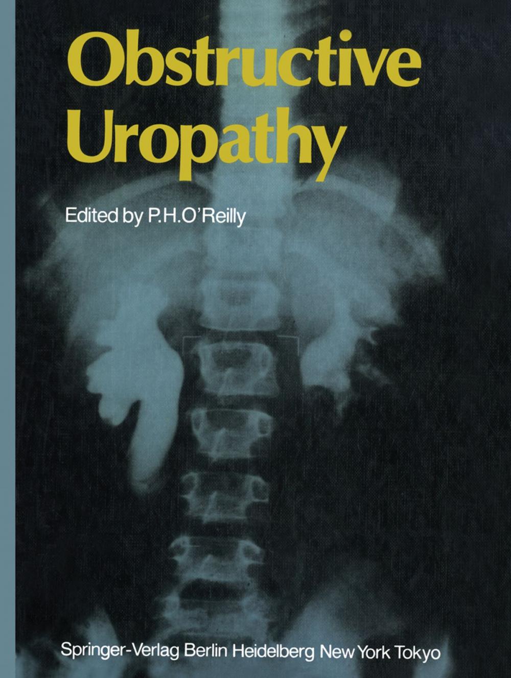 Big bigCover of Obstructive Uropathy