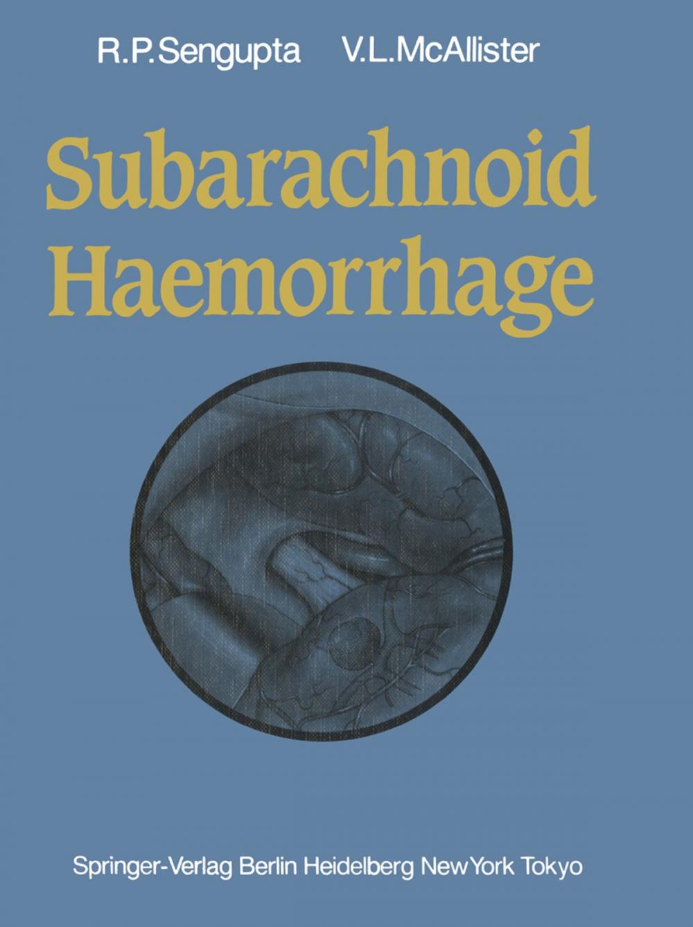 Big bigCover of Subarachnoid Haemorrhage
