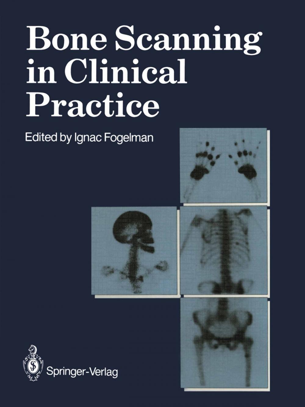 Big bigCover of Bone Scanning in Clinical Practice