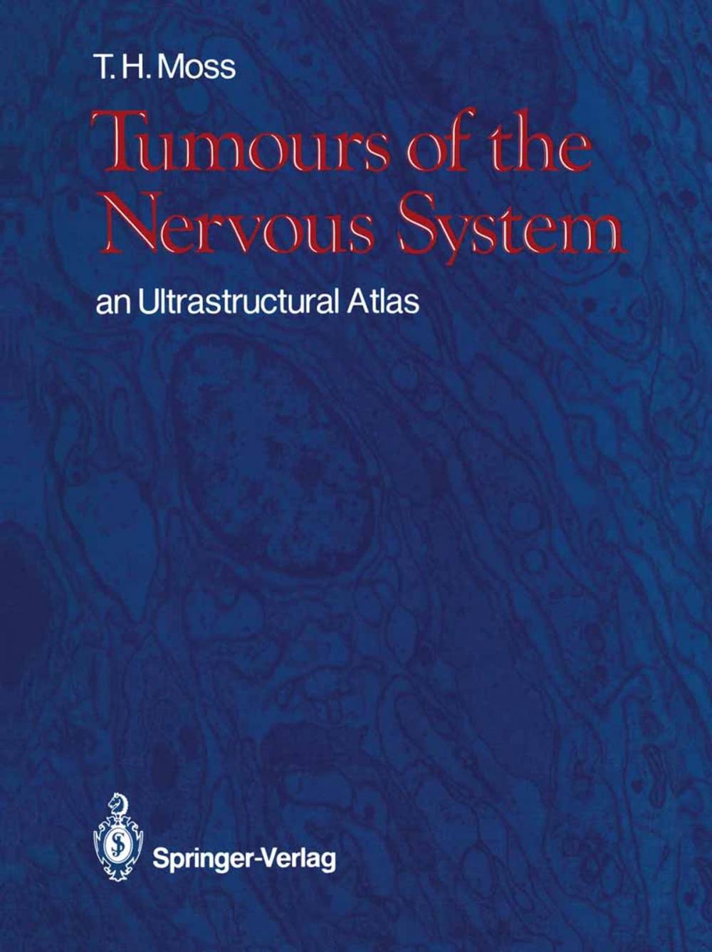 Big bigCover of Tumours of the Nervous System