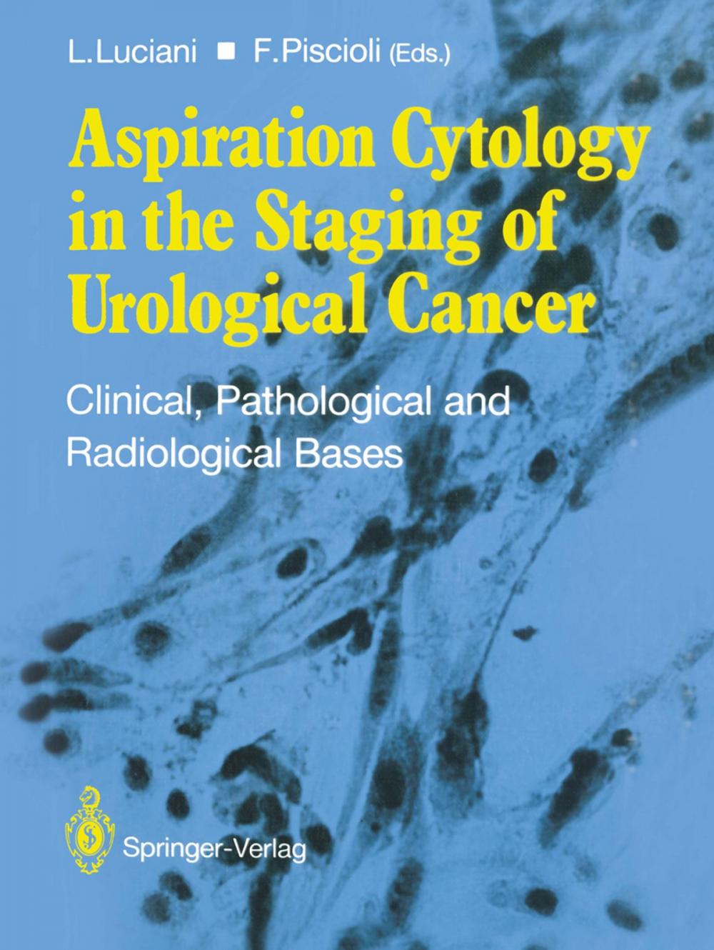 Big bigCover of Aspiration Cytology in the Staging of Urological Cancer