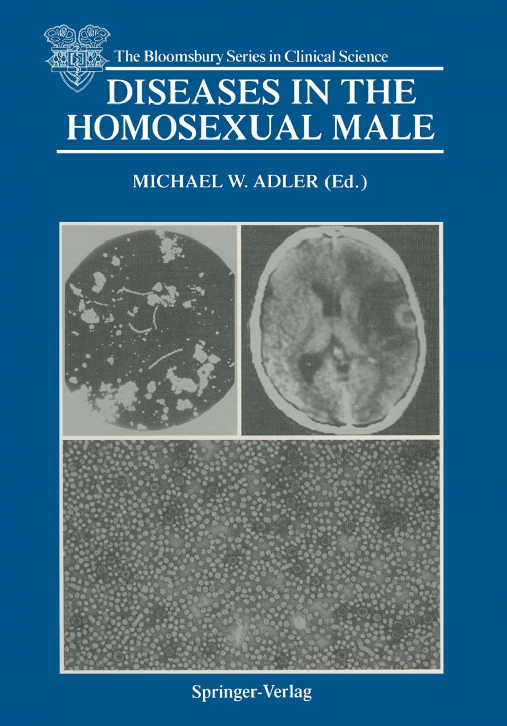 Big bigCover of Diseases in the Homosexual Male