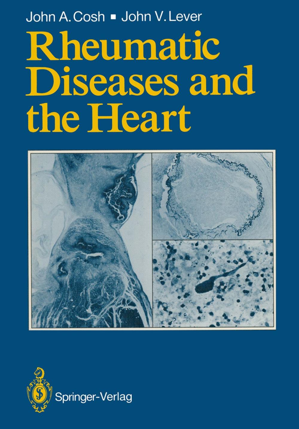 Big bigCover of Rheumatic Diseases and the Heart