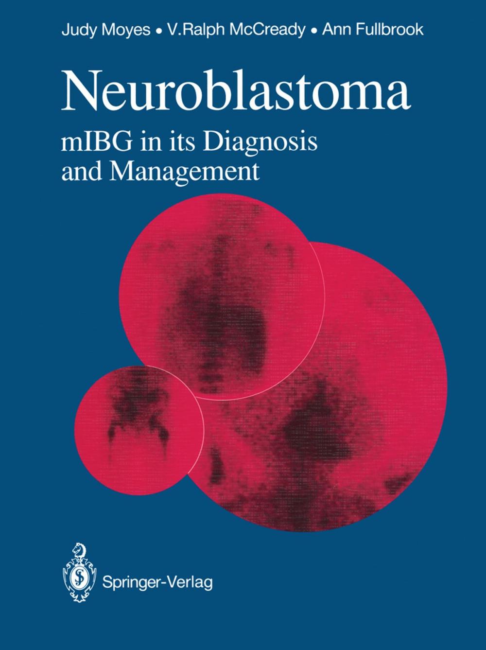 Big bigCover of Neuroblastoma