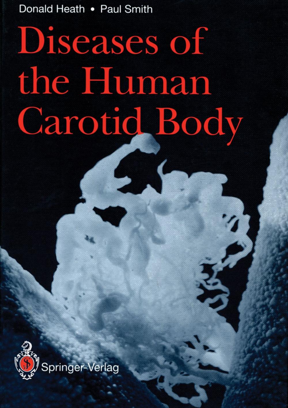 Big bigCover of Diseases of the Human Carotid Body