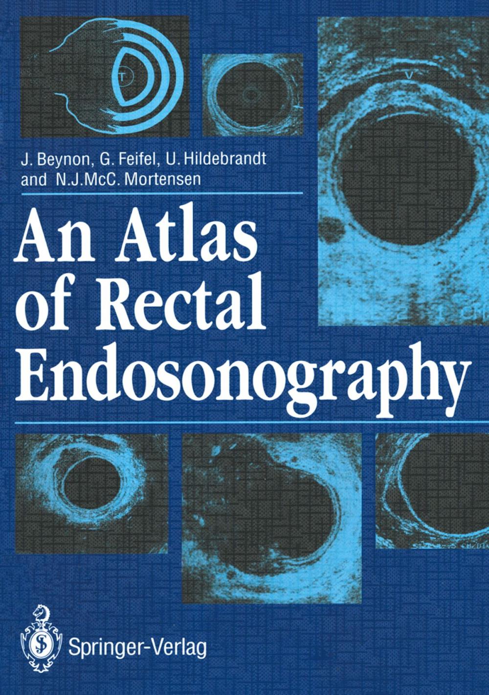 Big bigCover of An Atlas of Rectal Endosonography