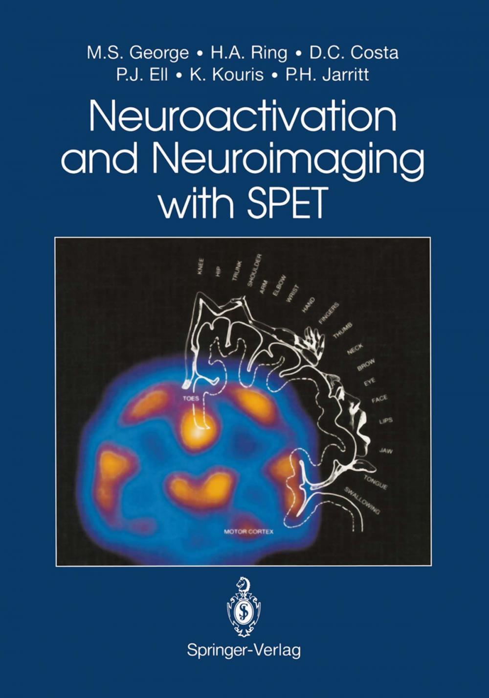 Big bigCover of Neuroactivation and Neuroimaging with SPET