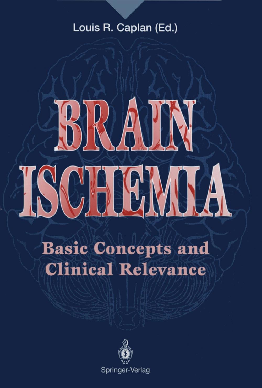 Big bigCover of Brain Ischemia