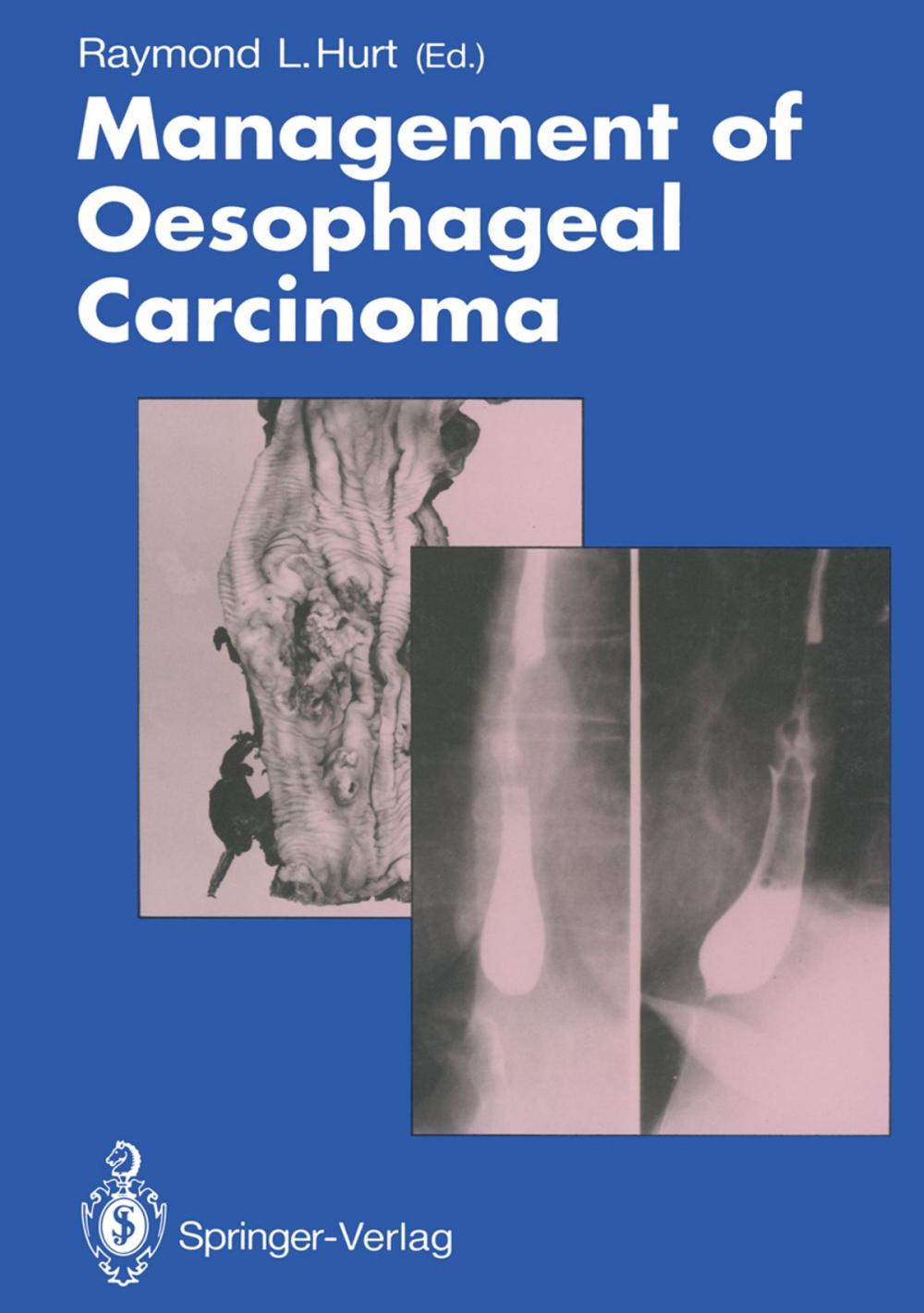 Big bigCover of Management of Oesophageal Carcinoma
