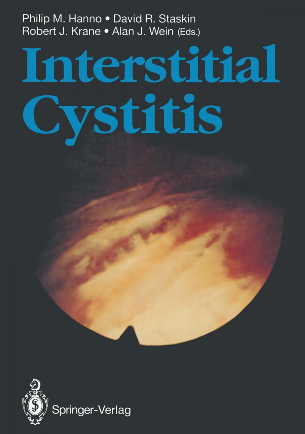 Big bigCover of Interstitial Cystitis