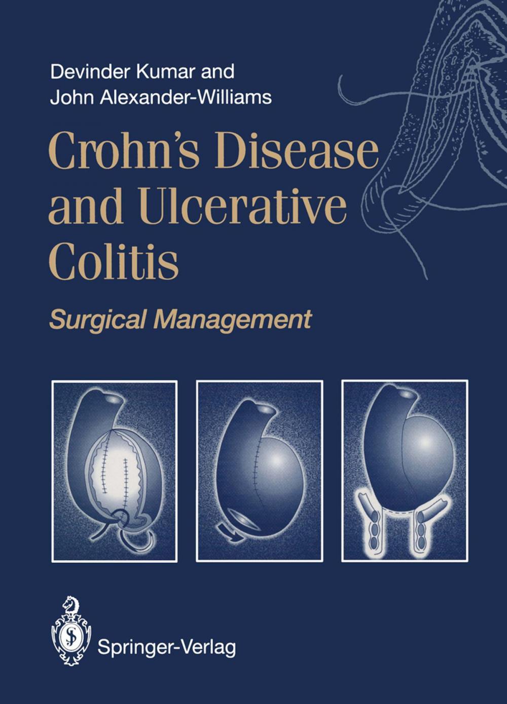 Big bigCover of Crohn’s Disease and Ulcerative Colitis