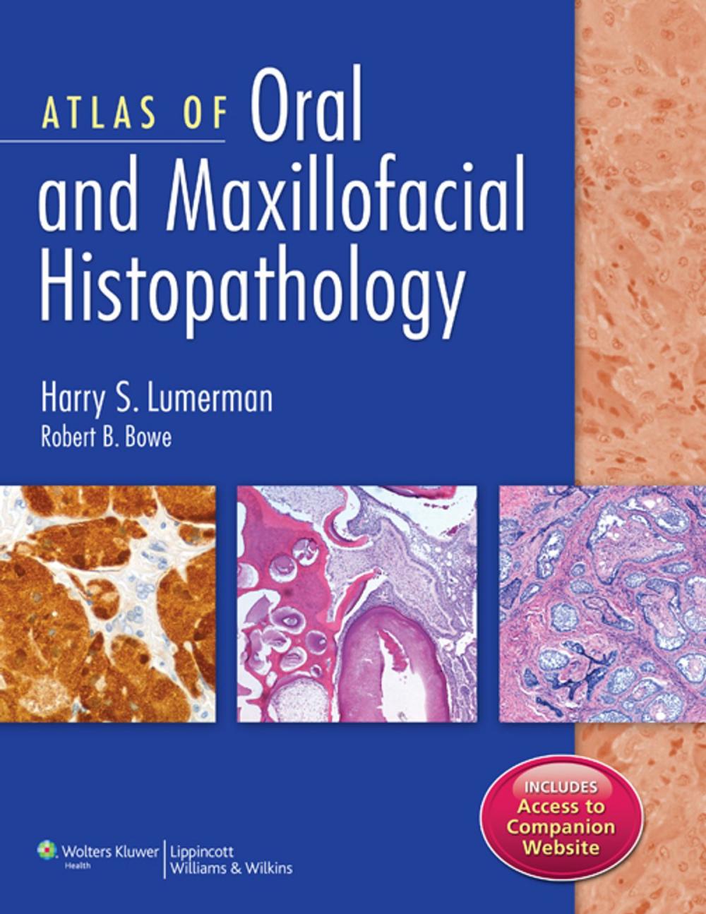 Big bigCover of Atlas of Oral and Maxillofacial Histopathology