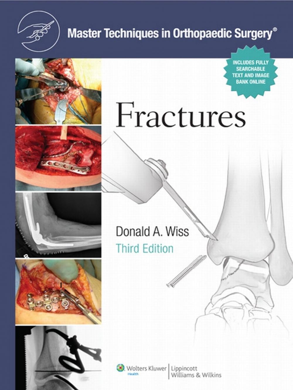 Big bigCover of Master Techniques in Orthopaedic Surgery: Fractures