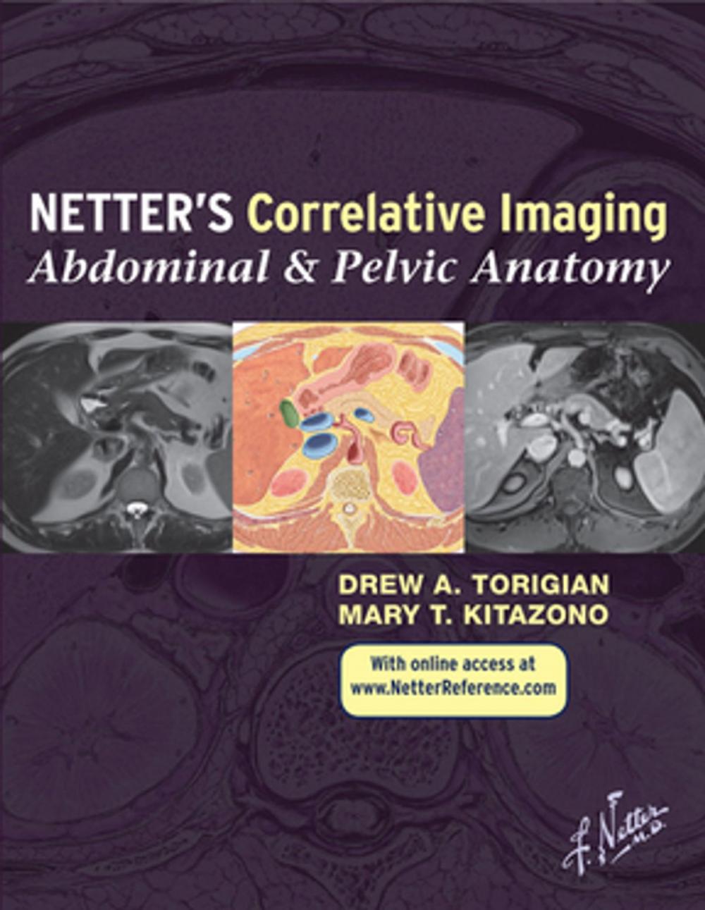 Big bigCover of Netter's Correlative Imaging: Abdominal and Pelvic Anatomy e-Book