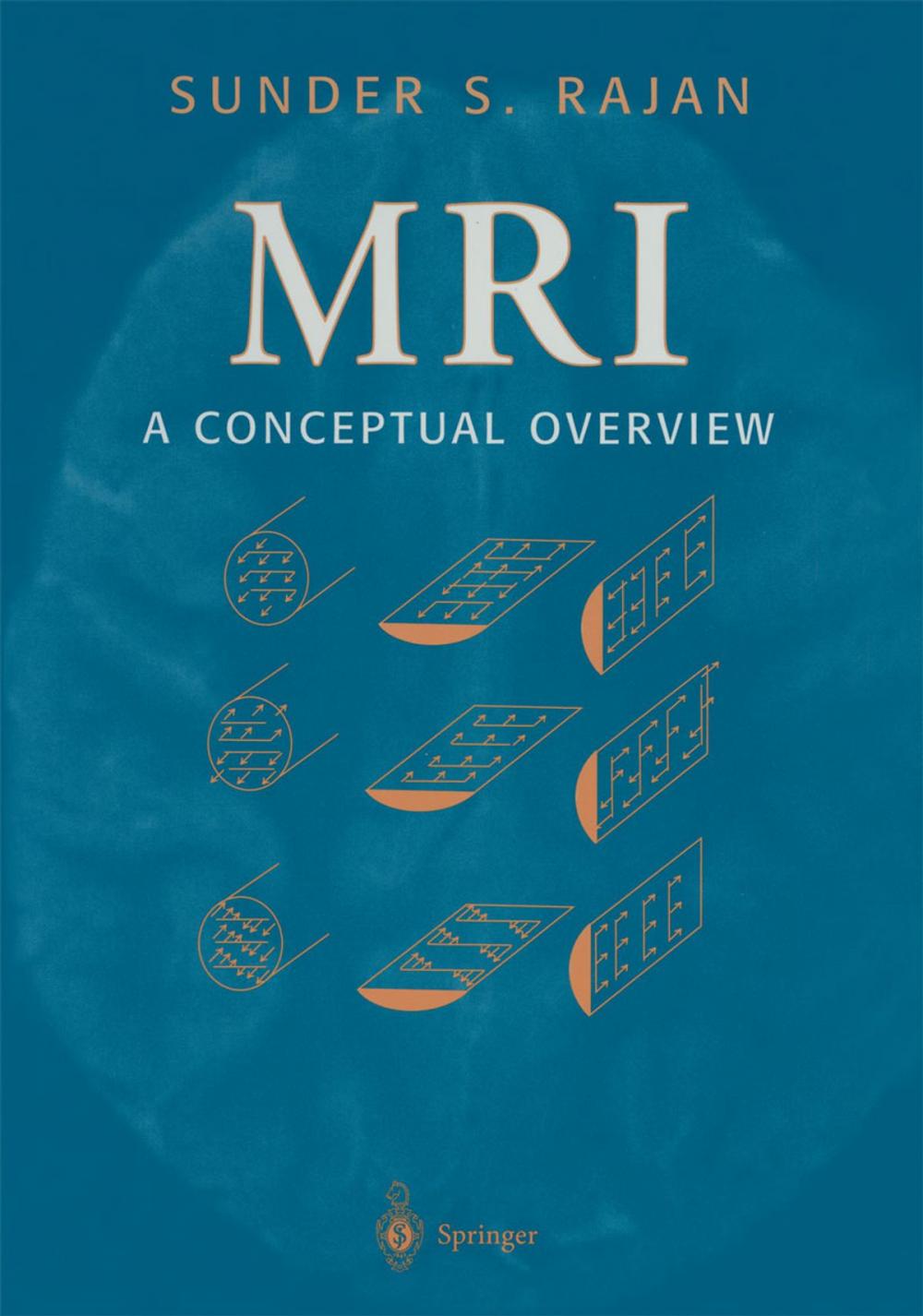 Big bigCover of MRI