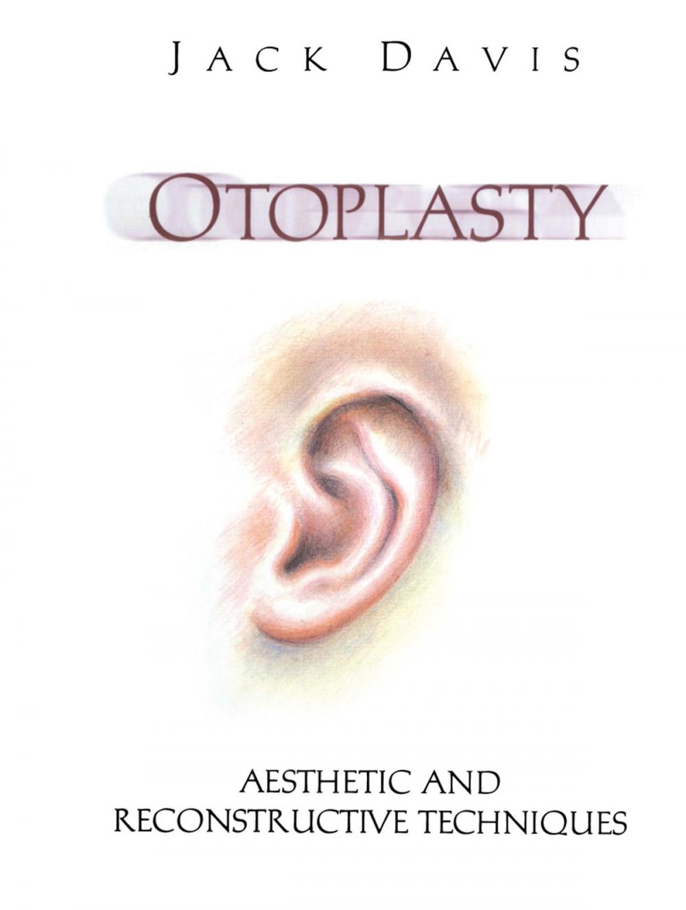 Big bigCover of Otoplasty