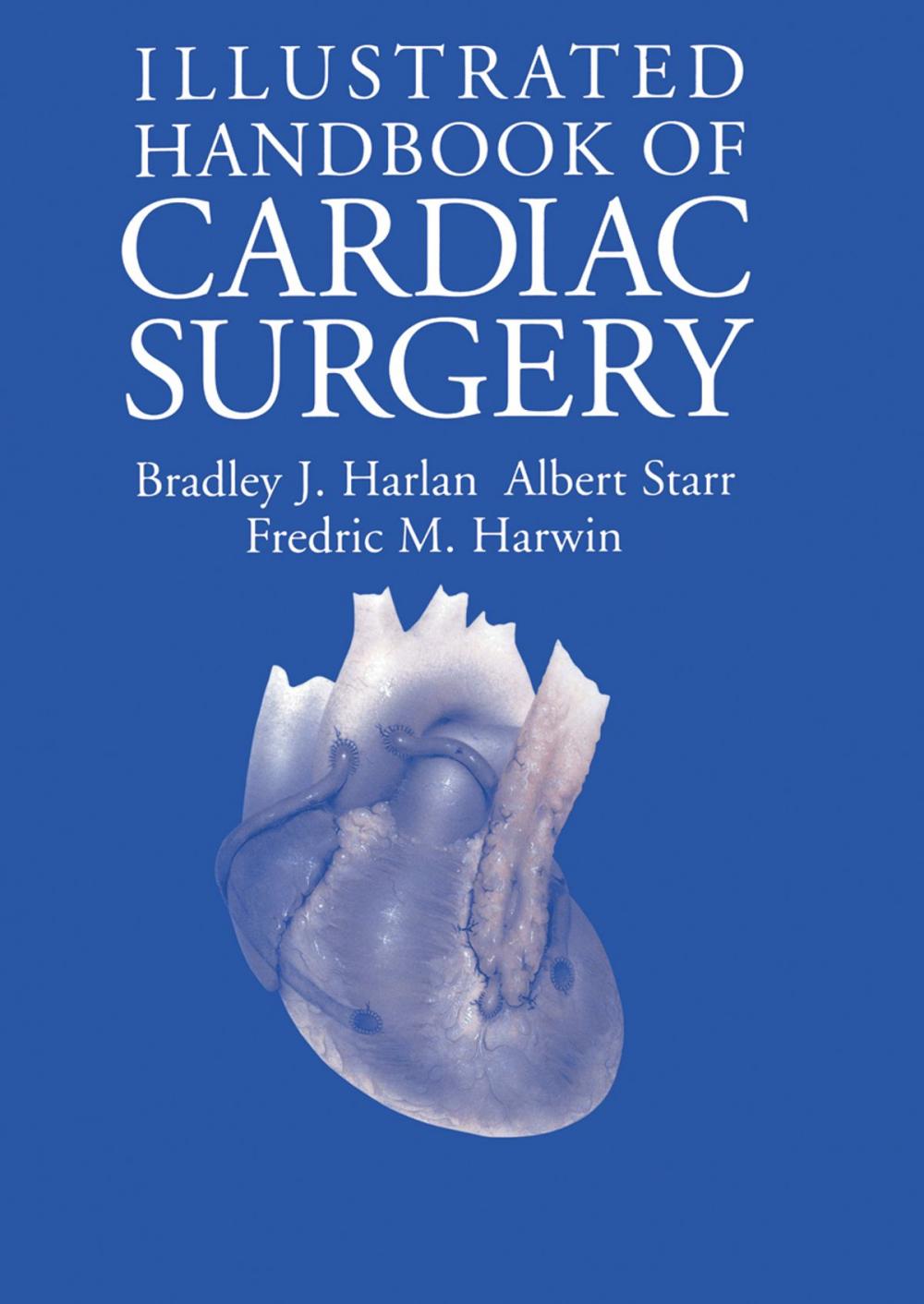 Big bigCover of Illustrated Handbook of Cardiac Surgery