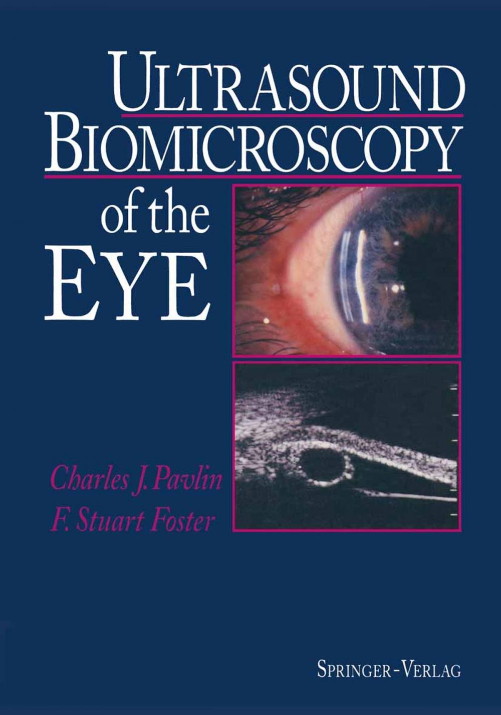 Big bigCover of Ultrasound Biomicroscopy of the Eye