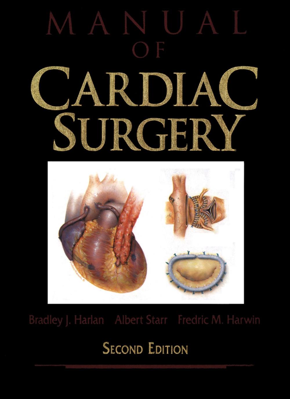 Big bigCover of Manual of Cardiac Surgery