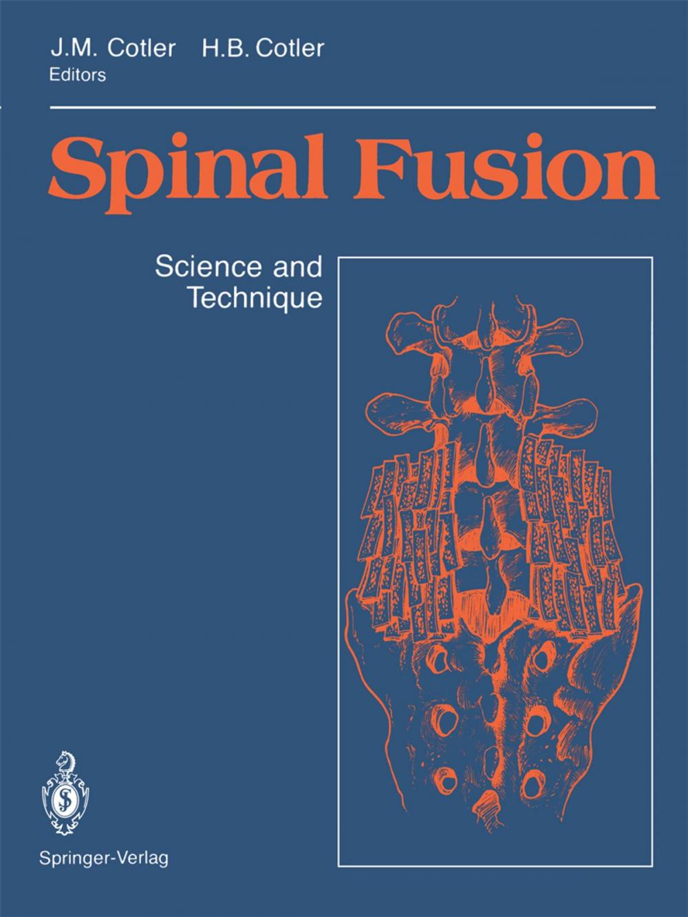 Big bigCover of Spinal Fusion