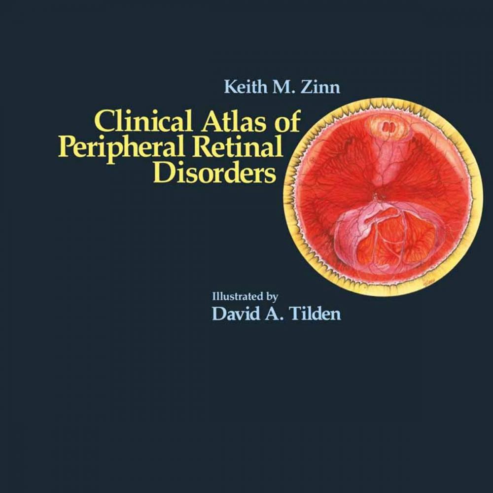 Big bigCover of Clinical Atlas of Peripheral Retinal Disorders