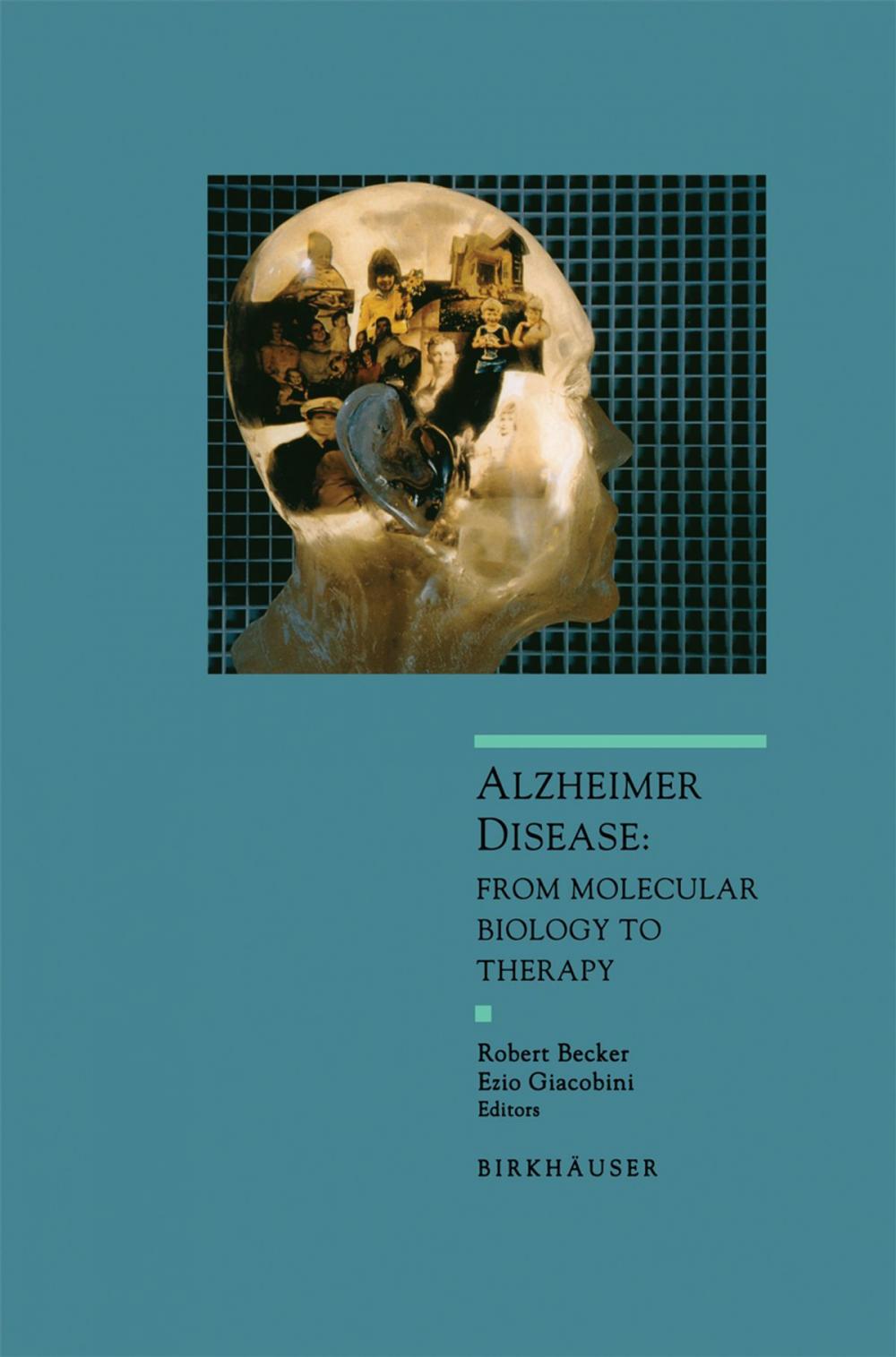 Big bigCover of Alzheimer Disease