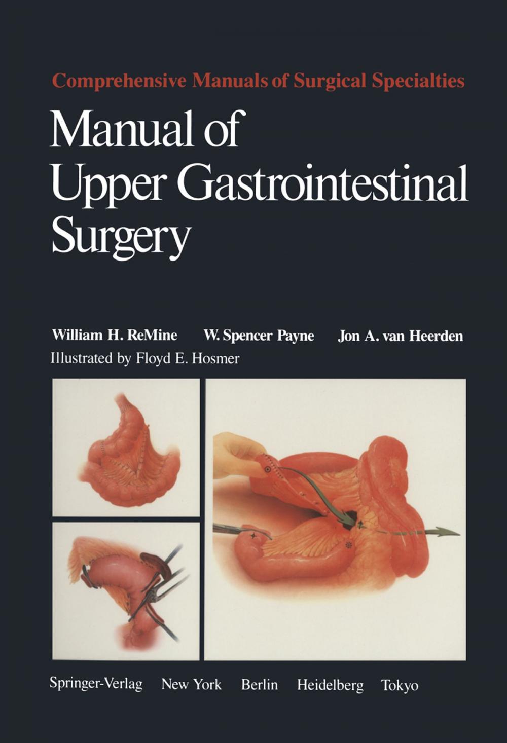 Big bigCover of Manual of Upper Gastrointestinal Surgery