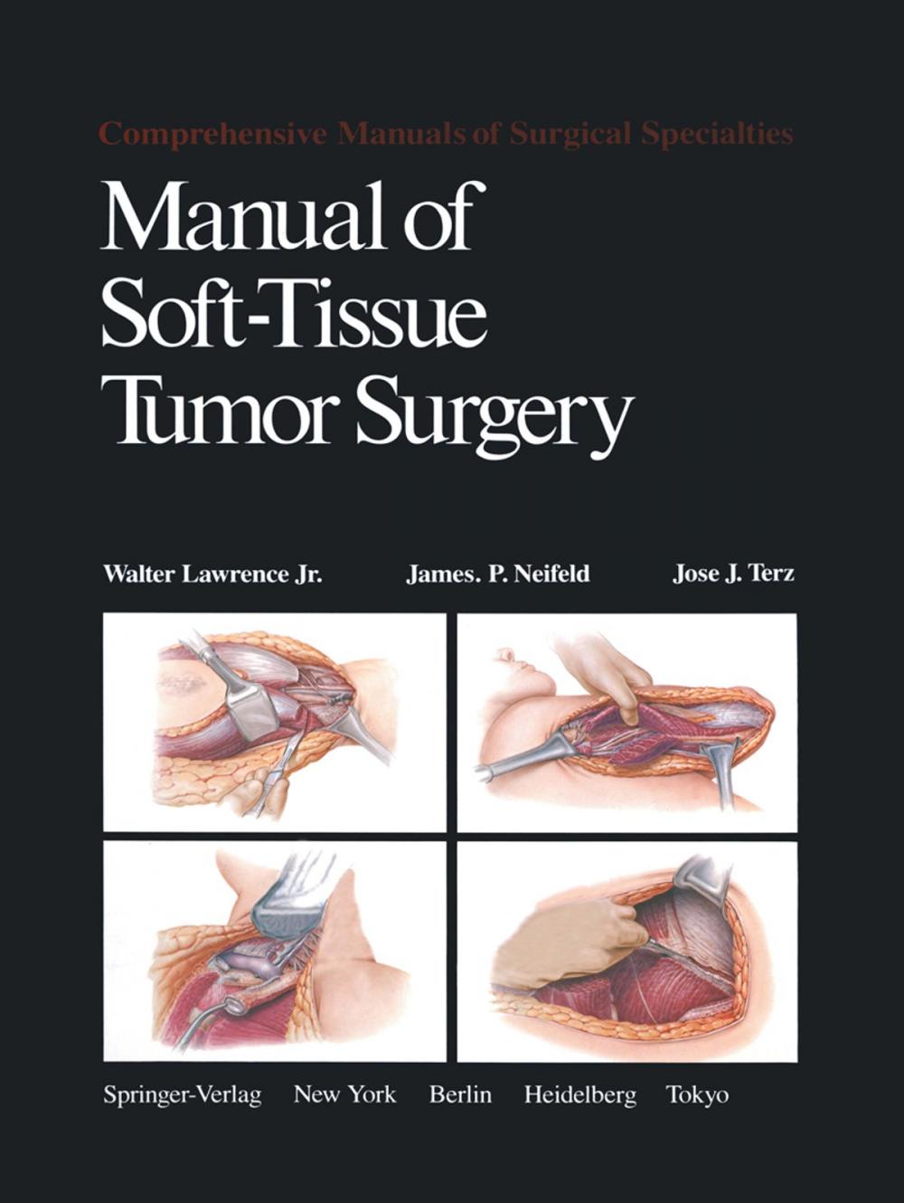 Big bigCover of Manual of Soft-Tissue Tumor Surgery