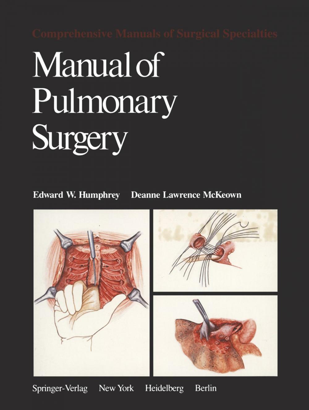 Big bigCover of Manual of Pulmonary Surgery