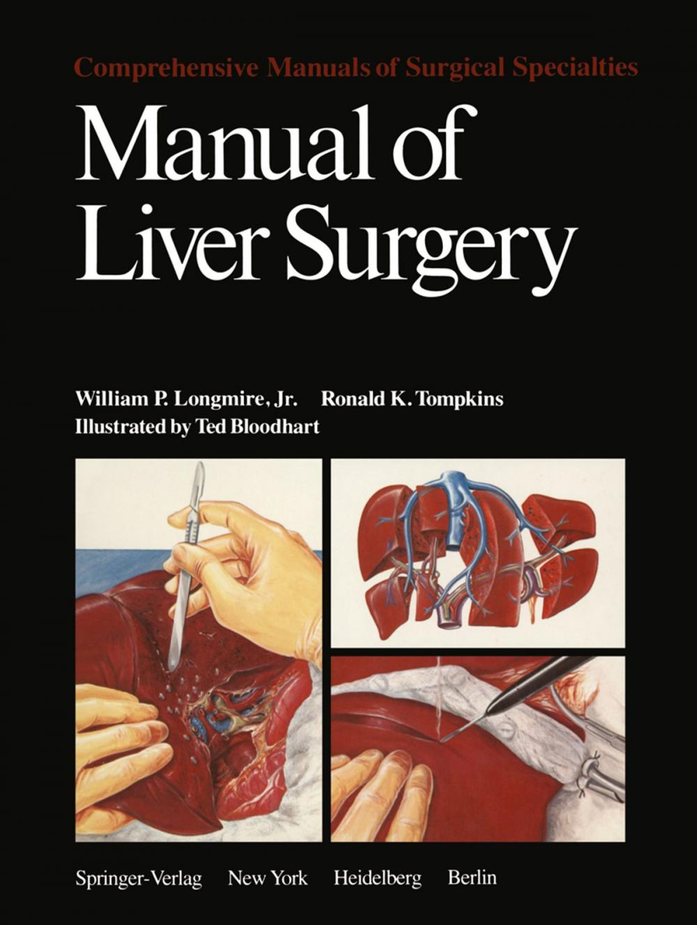 Big bigCover of Manual of Liver Surgery