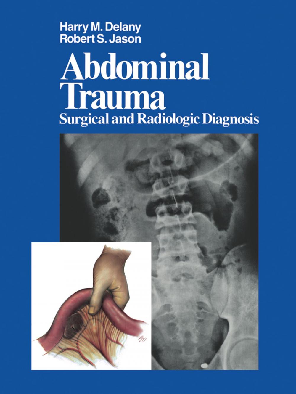 Big bigCover of Abdominal Trauma