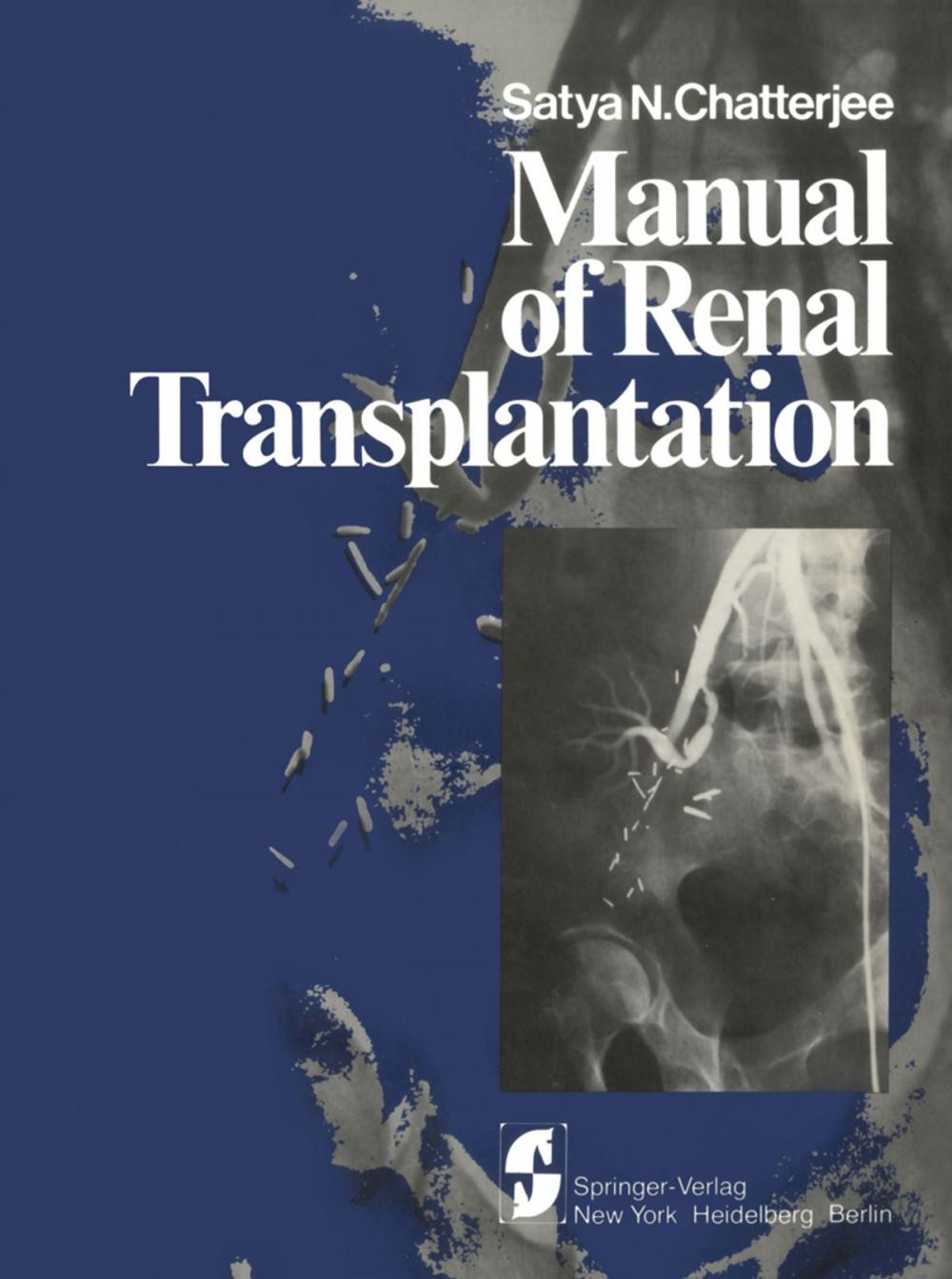 Big bigCover of Manual of Renal Transplantation