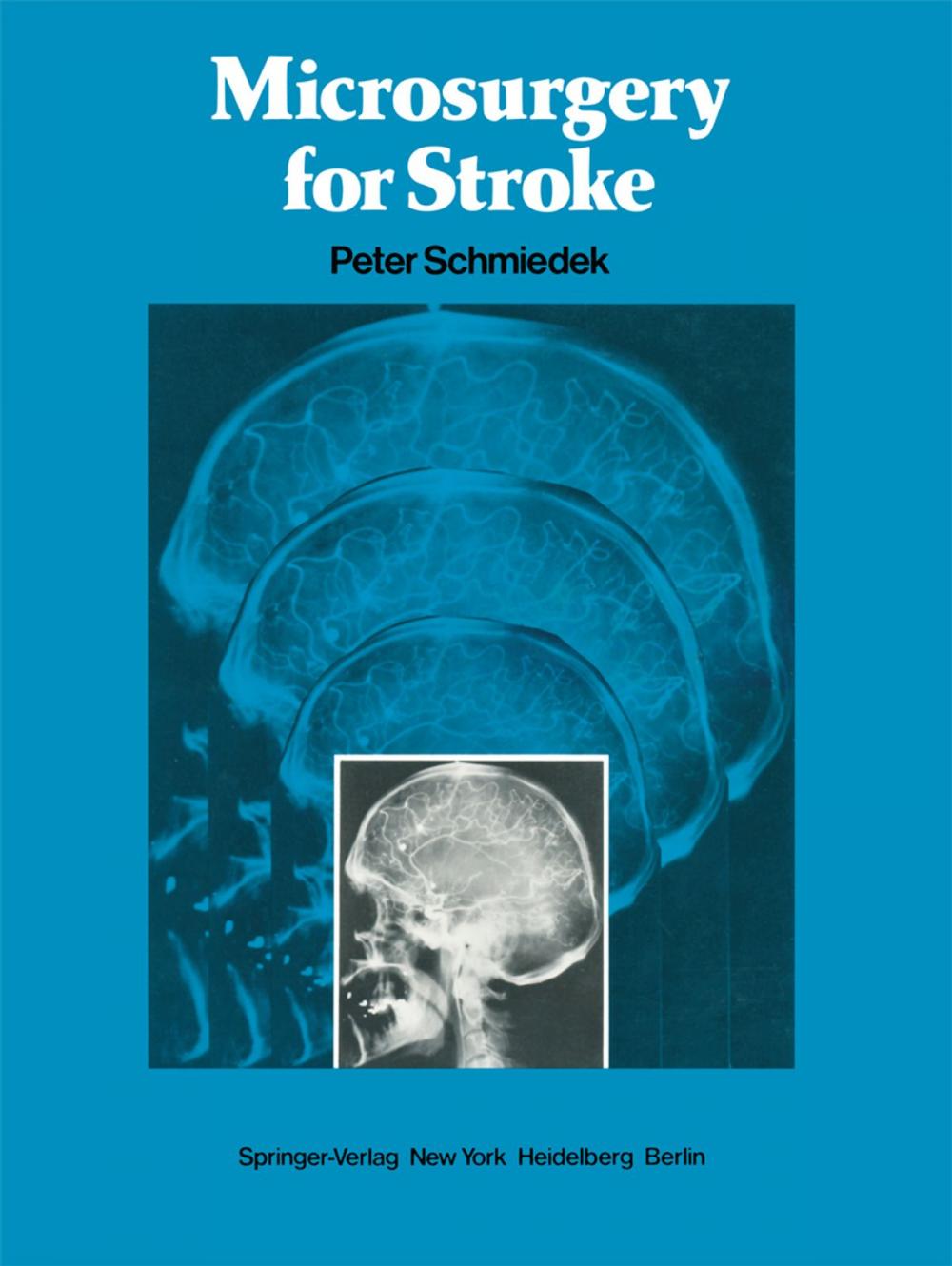 Big bigCover of Microsurgery for Stroke